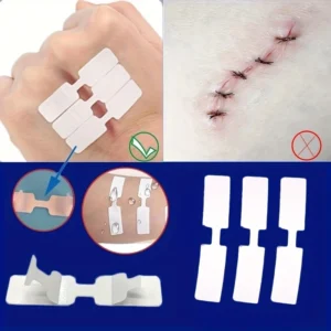 5 pezzi di nastro adesivo per ferite all'aperto usa e getta di primo soccorso cerotto per sutura della ferita cerotto per ferita cerotto per sutura rapida di emergenza
